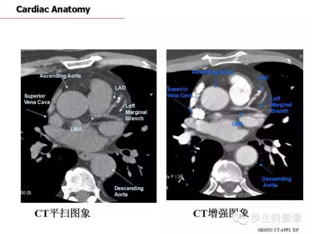 影像PPT - 史上最全断层解剖图谱-167