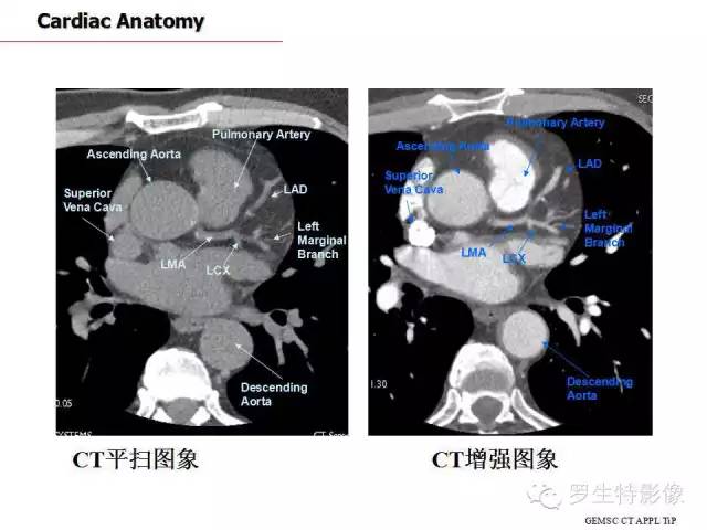 影像PPT - 史上最全断层解剖图谱-168