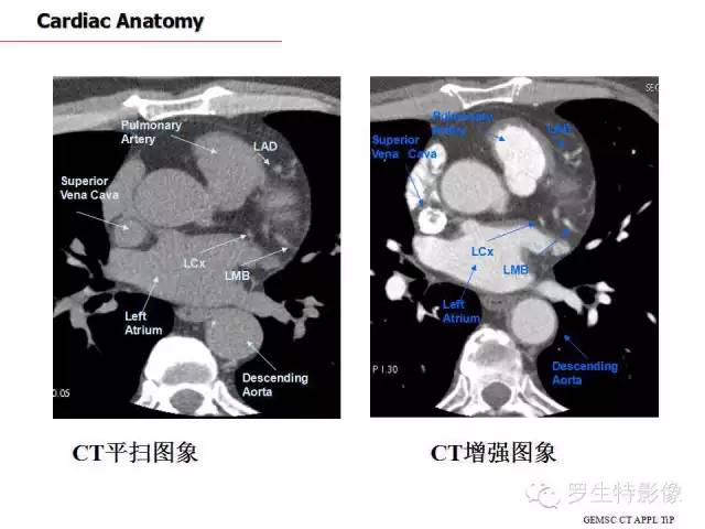 影像PPT - 史上最全断层解剖图谱-169