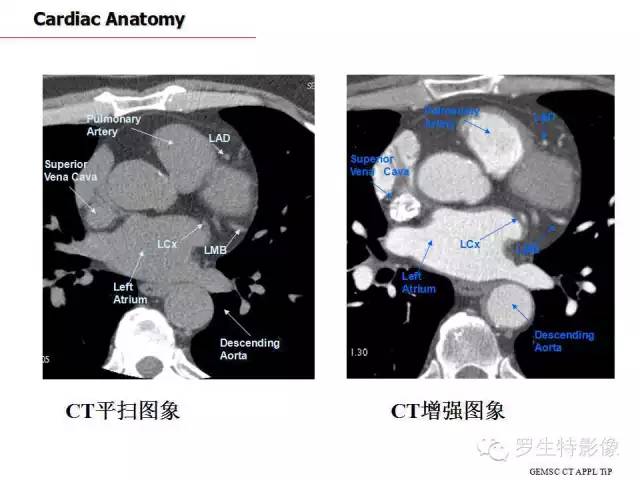 影像PPT - 史上最全断层解剖图谱-170
