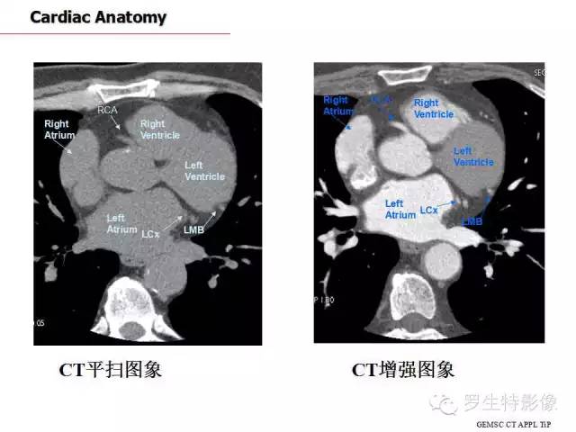 影像PPT - 史上最全断层解剖图谱-172