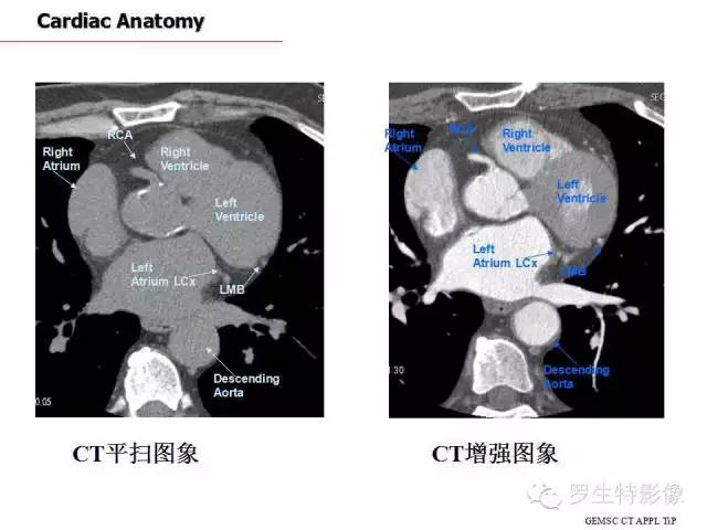影像PPT - 史上最全断层解剖图谱-174