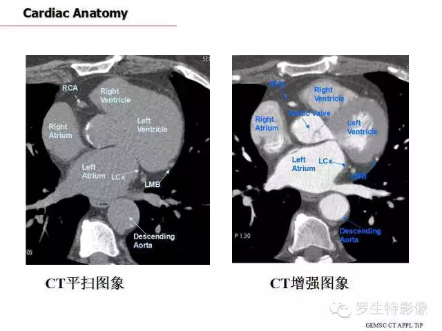 影像PPT - 史上最全断层解剖图谱-175