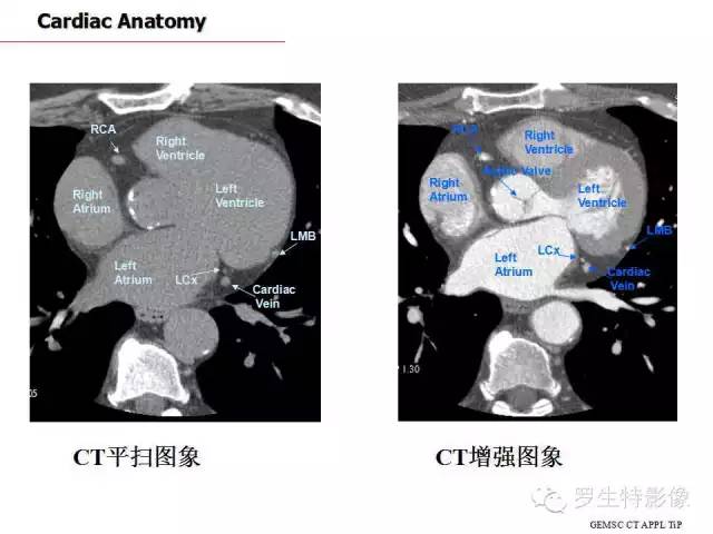 影像PPT - 史上最全断层解剖图谱-176