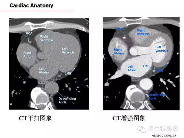 影像PPT - 史上最全断层解剖图谱-177
