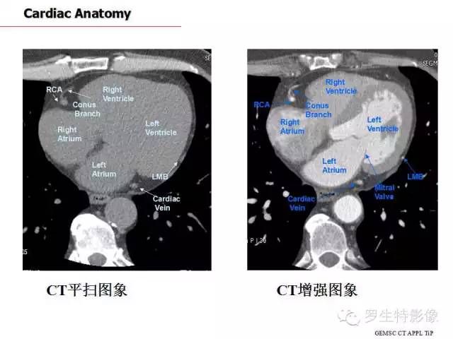 影像PPT - 史上最全断层解剖图谱-178