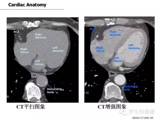 影像PPT - 史上最全断层解剖图谱-179