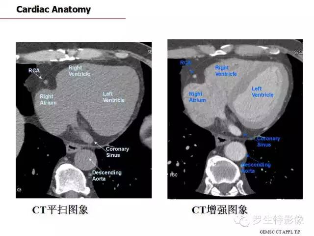 影像PPT - 史上最全断层解剖图谱-181