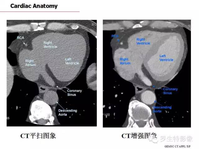 影像PPT - 史上最全断层解剖图谱-182