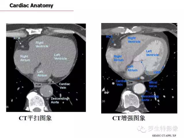 影像PPT - 史上最全断层解剖图谱-180