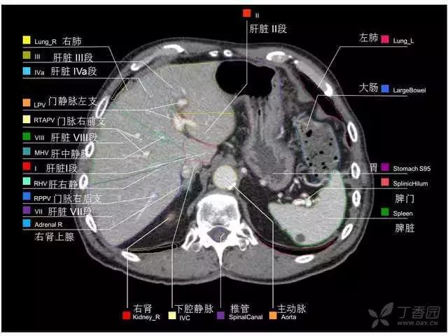 影像PPT - 史上最全断层解剖图谱-212