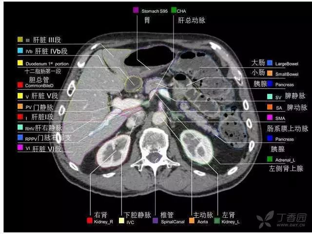 影像PPT - 史上最全断层解剖图谱-222
