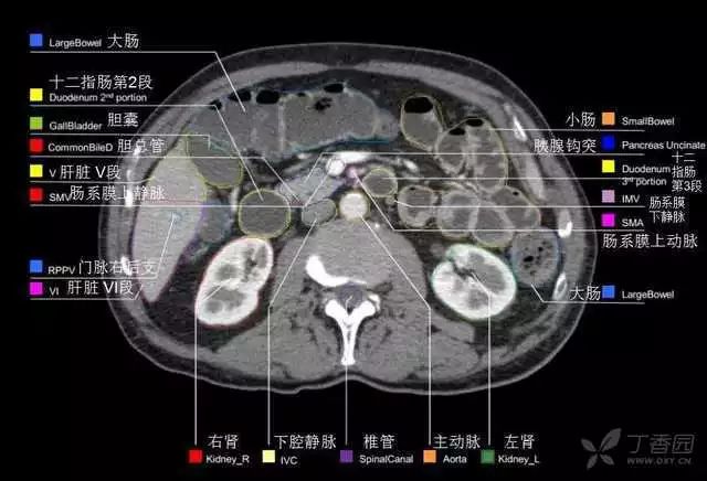 影像PPT - 史上最全断层解剖图谱-237
