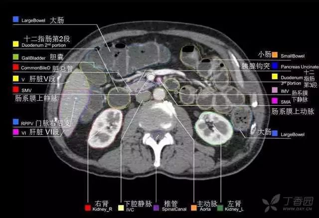 影像PPT - 史上最全断层解剖图谱-238