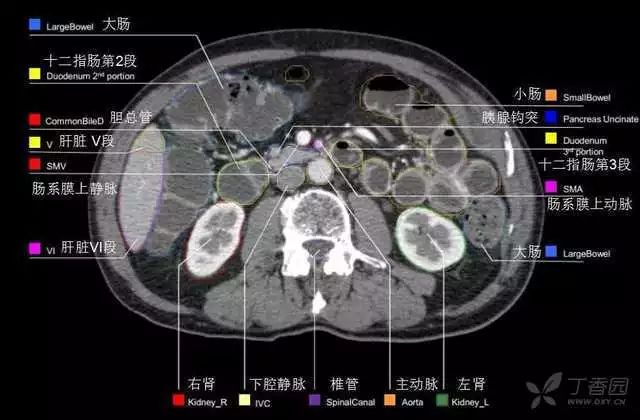 影像PPT - 史上最全断层解剖图谱-241