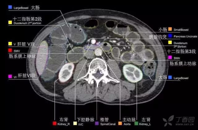 影像PPT - 史上最全断层解剖图谱-243