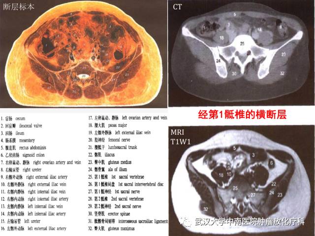 影像PPT - 史上最全断层解剖图谱-245