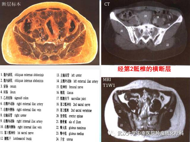 影像PPT - 史上最全断层解剖图谱-246