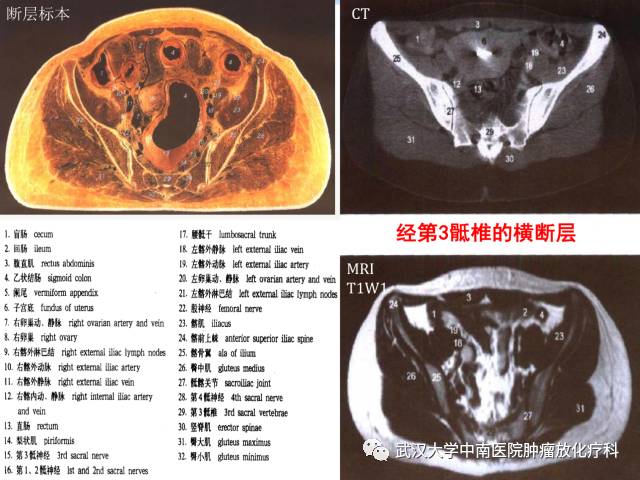 影像PPT - 史上最全断层解剖图谱-248