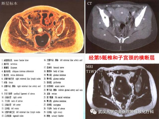 影像PPT - 史上最全断层解剖图谱-251