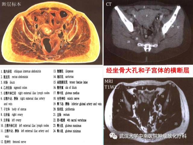 影像PPT - 史上最全断层解剖图谱-250