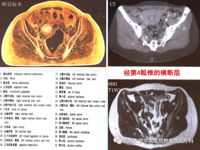 影像PPT - 史上最全断层解剖图谱-249