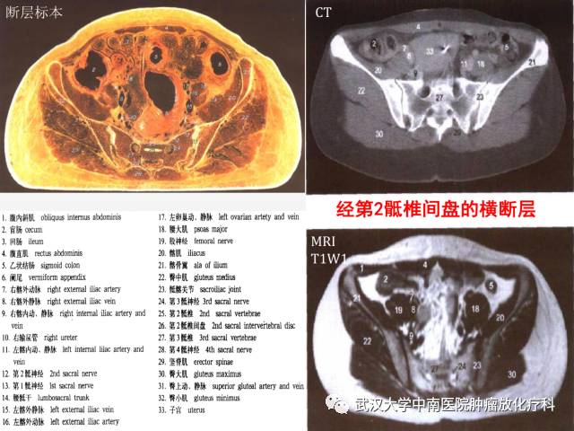 影像PPT - 史上最全断层解剖图谱-247
