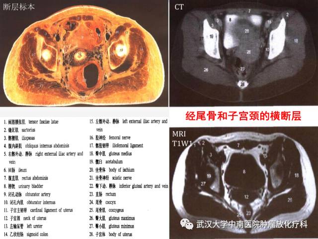 影像PPT - 史上最全断层解剖图谱-252