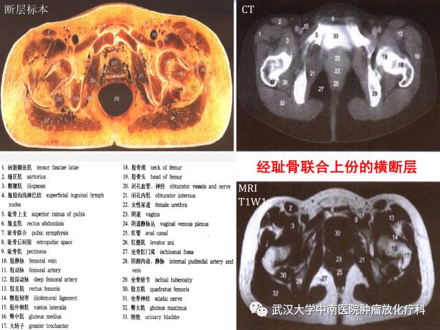 影像PPT - 史上最全断层解剖图谱-255