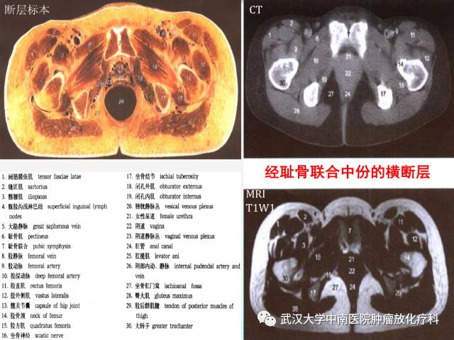 影像PPT - 史上最全断层解剖图谱-256
