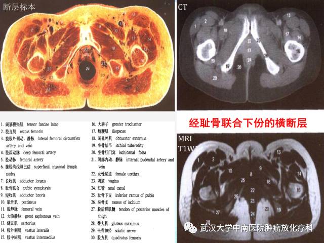 影像PPT - 史上最全断层解剖图谱-257