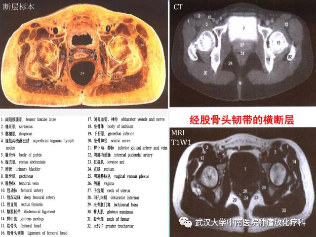 影像PPT - 史上最全断层解剖图谱-254