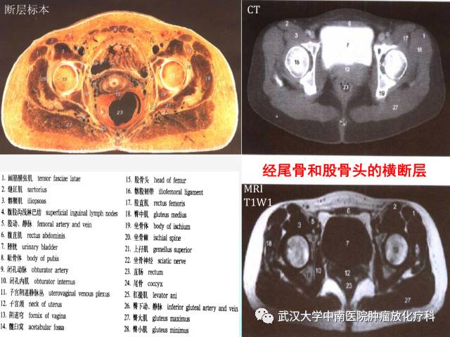影像PPT - 史上最全断层解剖图谱-253