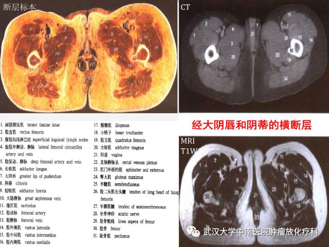 影像PPT - 史上最全断层解剖图谱-259