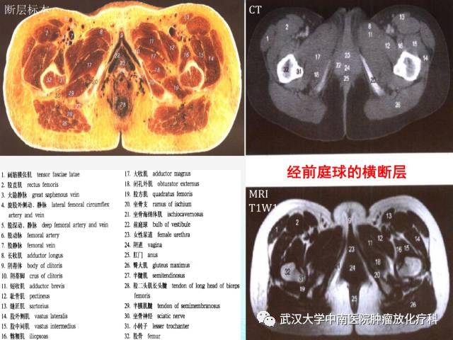 影像PPT - 史上最全断层解剖图谱-258