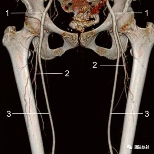 影像PPT - 史上最全断层解剖图谱-283