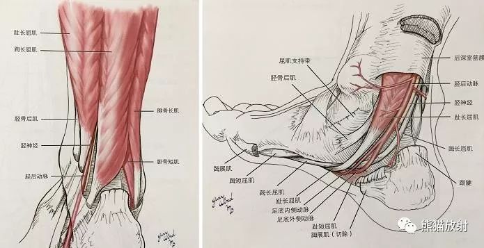 影像PPT - 史上最全断层解剖图谱-292