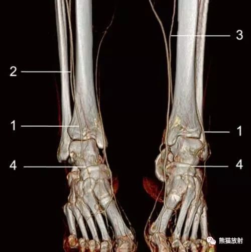 影像PPT - 史上最全断层解剖图谱-288