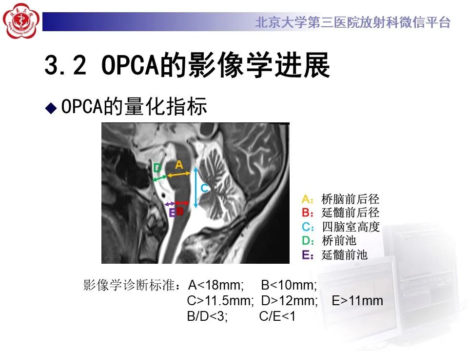 影像PPT - 【PPT】橄榄桥脑小脑萎缩影像诊断-24