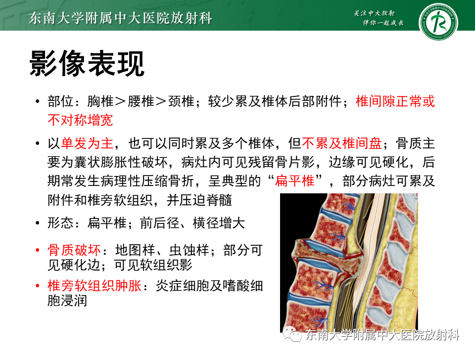 影像PPT - 【病例】脊柱朗格汉斯组织细胞增生症1例CT-9