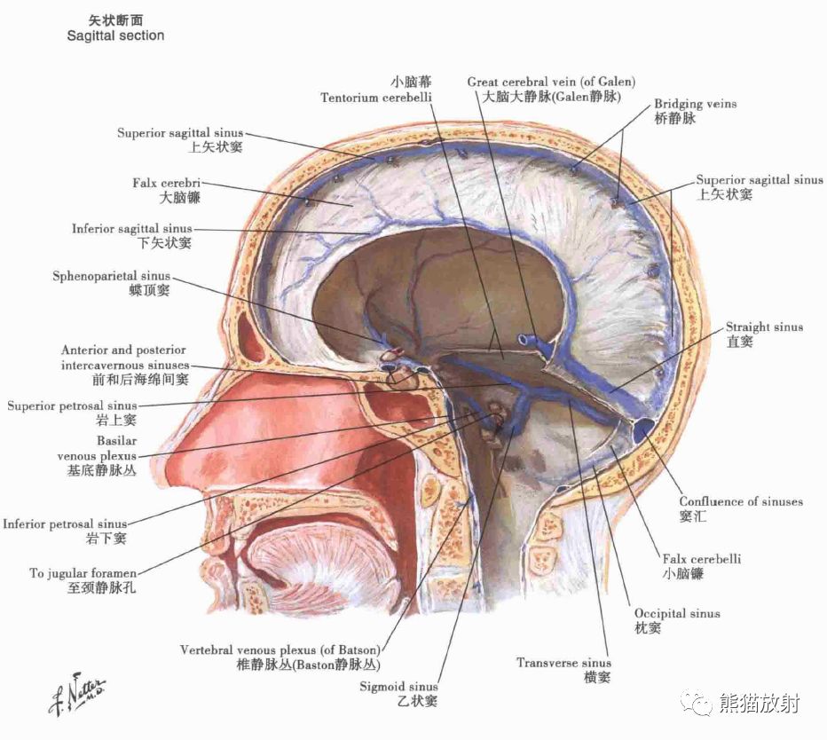 影像PPT - 脑膜解剖及其血供、硬脑膜静脉窦、MRV-5 影像PPT - 脑膜解剖及其血供、硬脑膜静脉窦、MRV-5