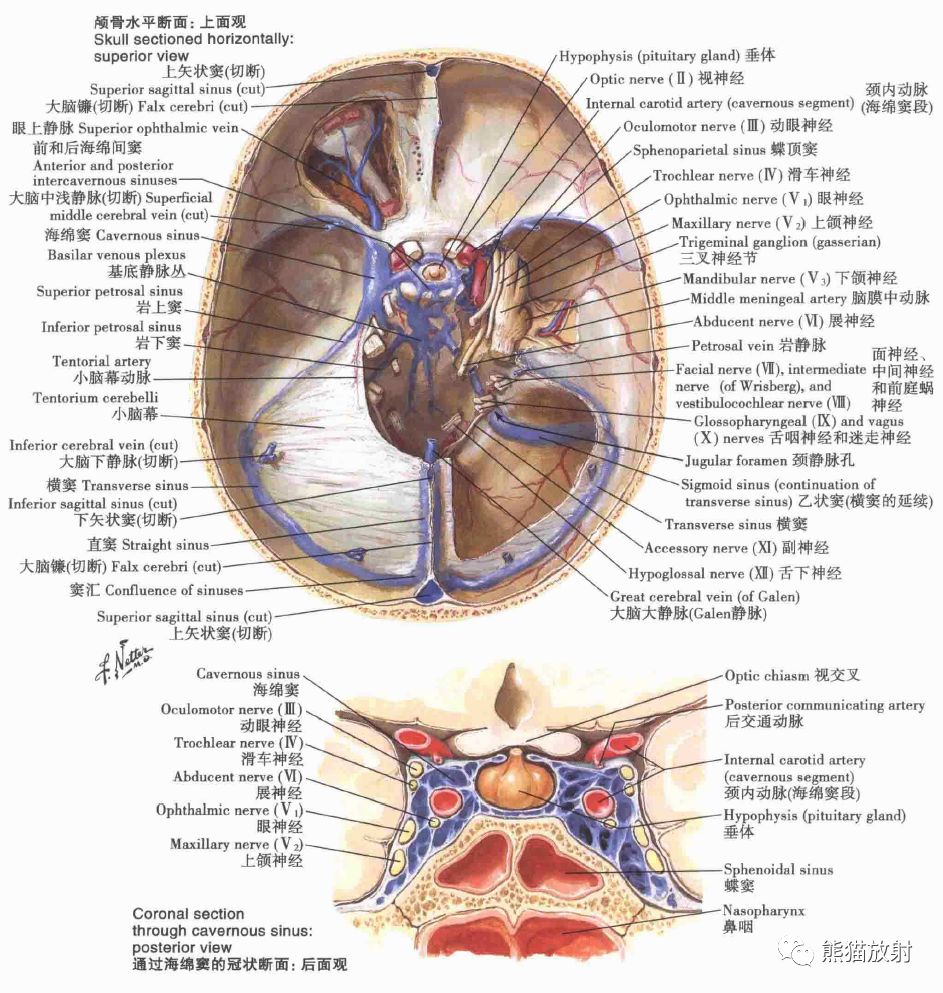 影像PPT - 脑膜解剖及其血供、硬脑膜静脉窦、MRV-6 影像PPT - 脑膜解剖及其血供、硬脑膜静脉窦、MRV-6