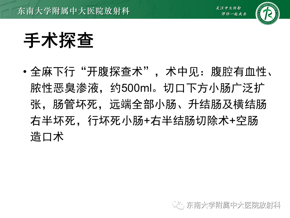 影像PPT - 【PPT】门静脉积气-2 影像PPT - 【PPT】门静脉积气-2