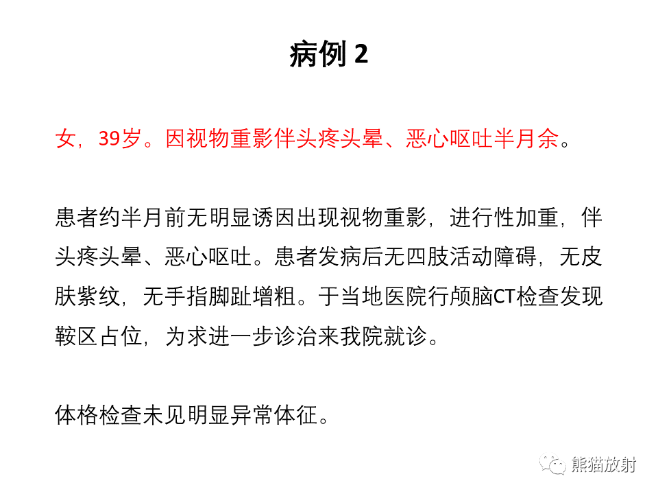 影像PPT - 【PPT】常见鞍旁及海绵窦部位肿瘤MRI诊断-12
