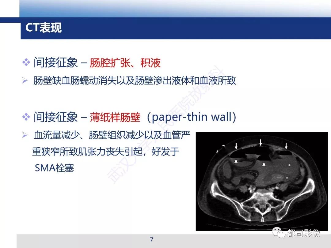 影像PPT - 【PPT】急性肠系膜血管缺血的CT诊断及介入治疗-7