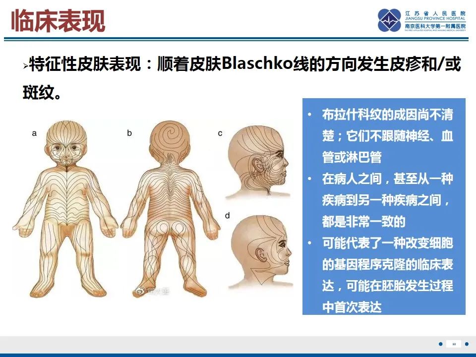 影像PPT - 【PPT】色素失禁症的影像表现-24