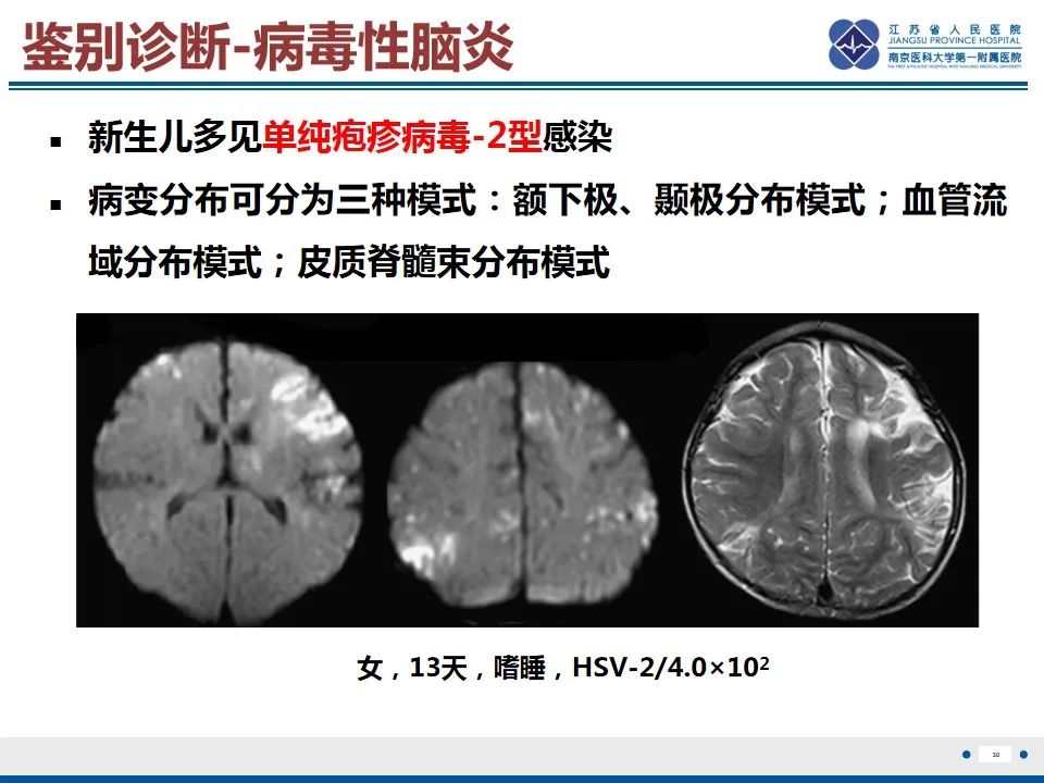 影像PPT - 【PPT】色素失禁症的影像表现-32