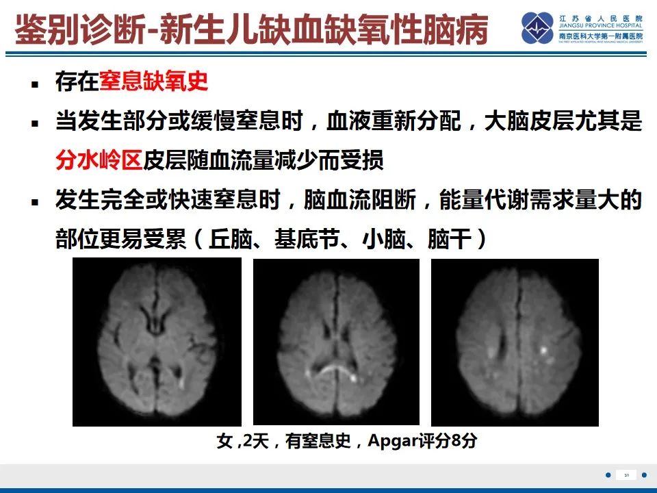 影像PPT - 【PPT】色素失禁症的影像表现-33