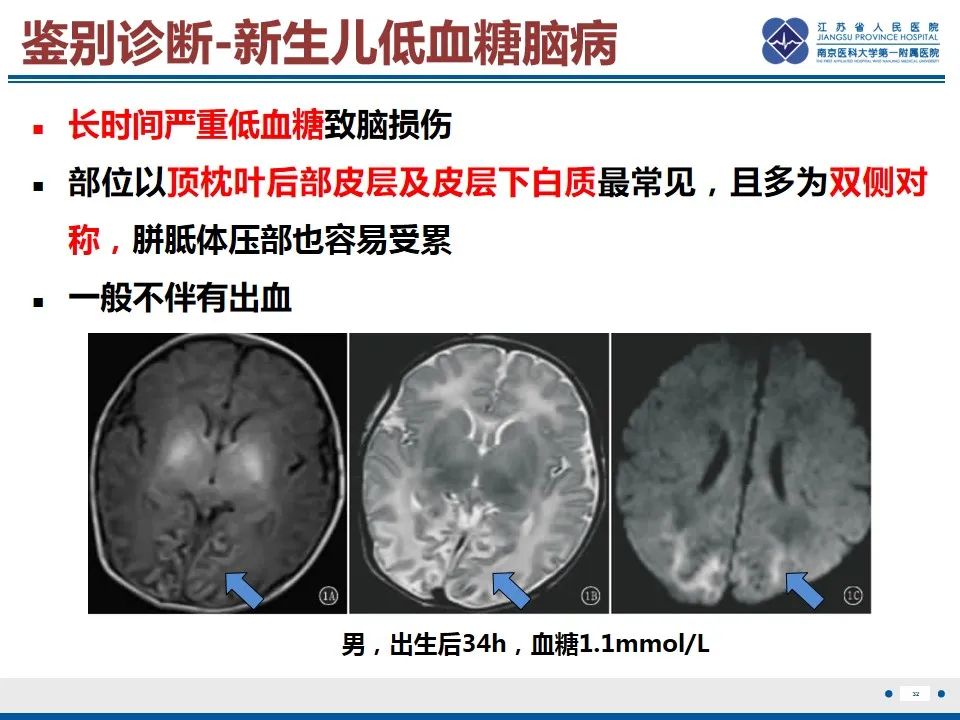 影像PPT - 【PPT】色素失禁症的影像表现-34