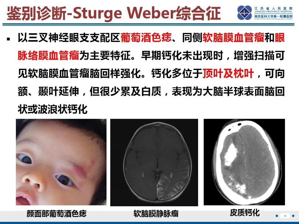 影像PPT - 【PPT】色素失禁症的影像表现-35
